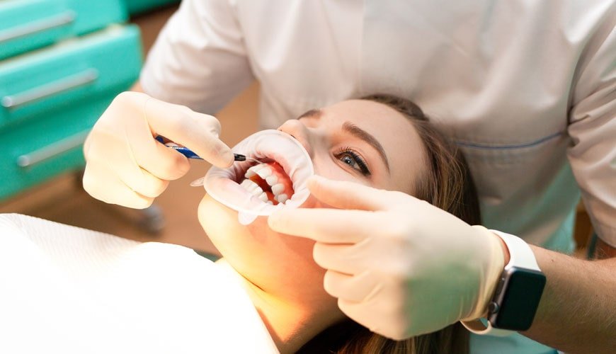 bleaching yöntemi ile ilgili bilmeniz gerekenler